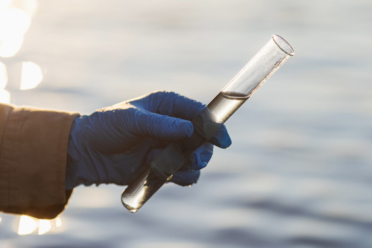 Συναγερμός για το βακτήριο Vibrio που εξαπλώνεται στις ακτές της Ευρώπης - Οι κίνδυνοι και τα συμπτώματα