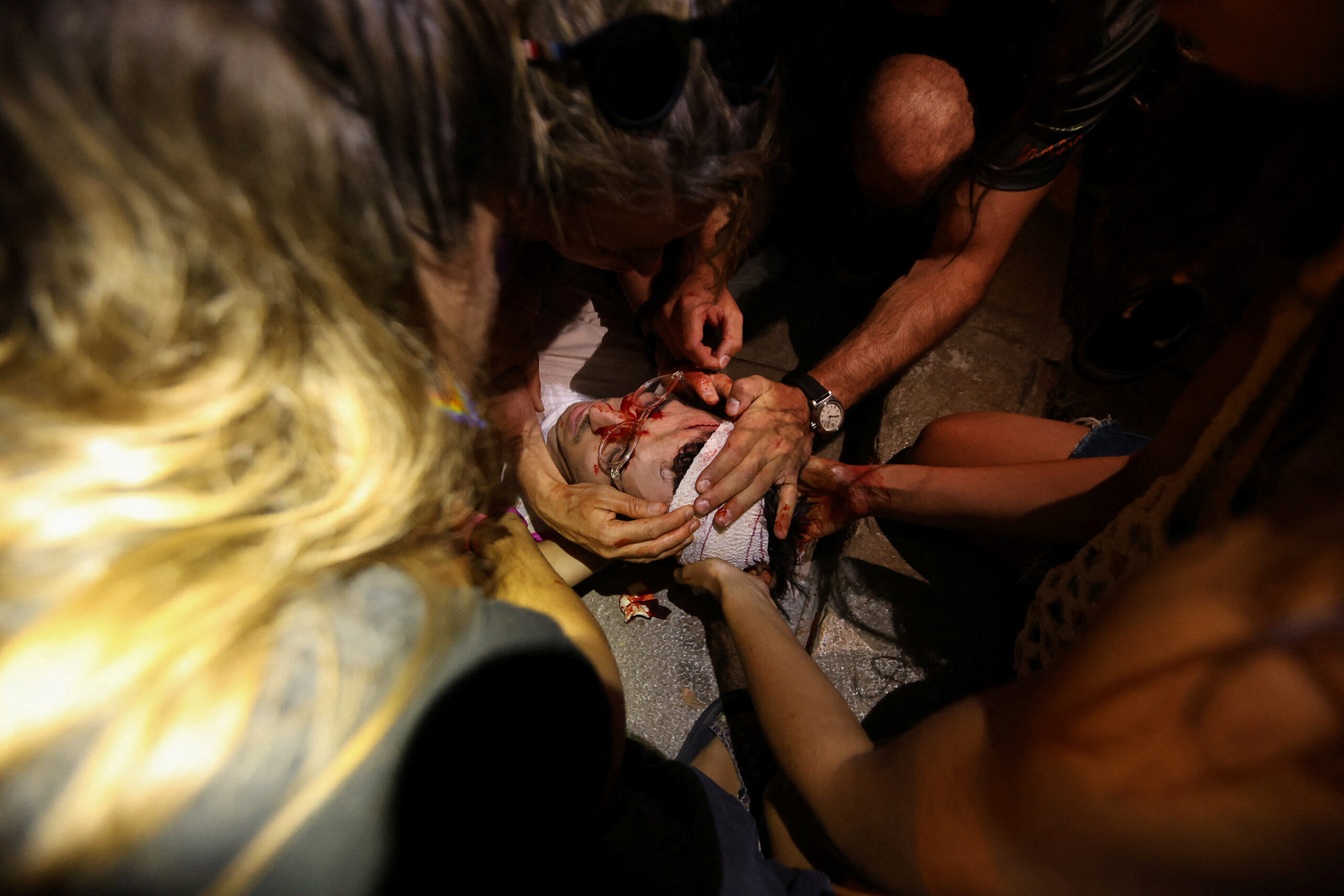 Τραυματίας κατά τη διάρκεια διαδηλώσεων στη Μαγιόρκα