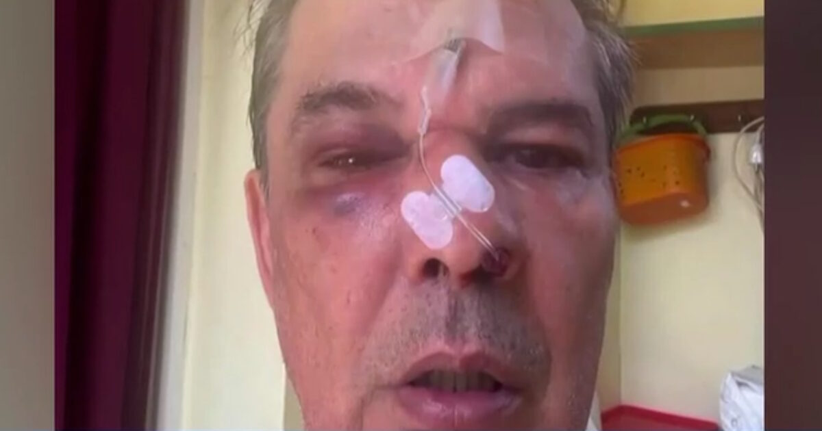 Χαϊδάρι: «Μου ‘χει σπάσει το κόκκαλο στη μύτη» λέει ο άνδρας που έπεσε θύμα ξυλοδαρμού μέσα σε ιατρείο
