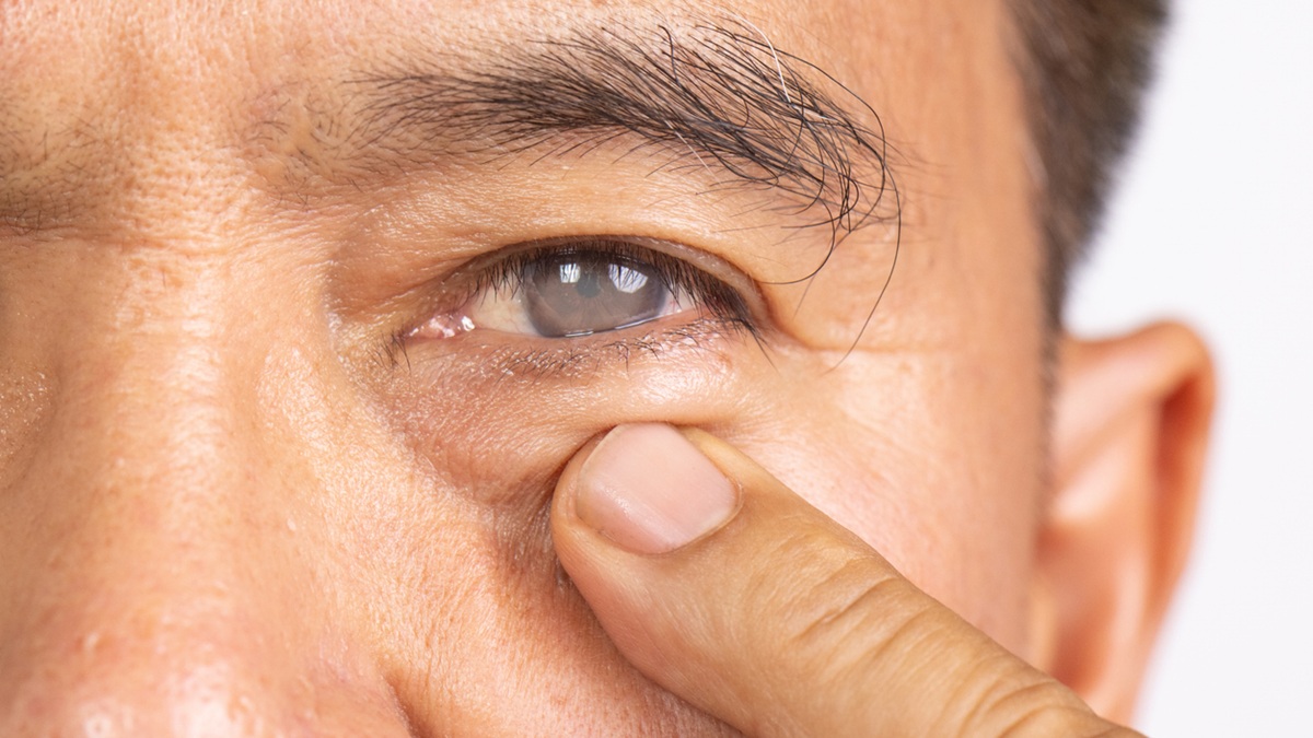 Πηγή φωτό: iStock