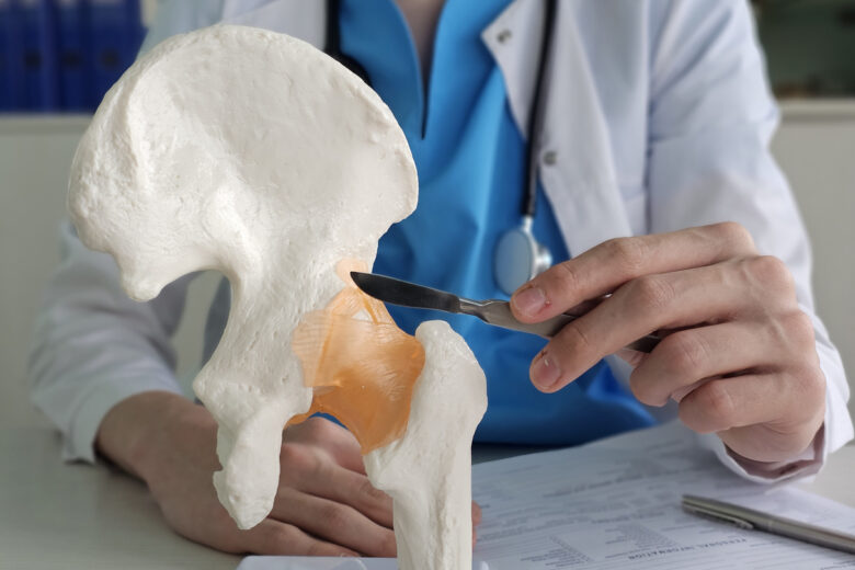Hip replacement surgery. A doctor holds a scalpel. Hip arthroplasty concept