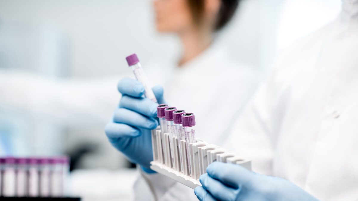 Laboratory assistant putting test tubes into the holder, Close-up view focused on the tubes